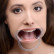 Расширитель рта Cheek Retractor Dental Mouth Gag